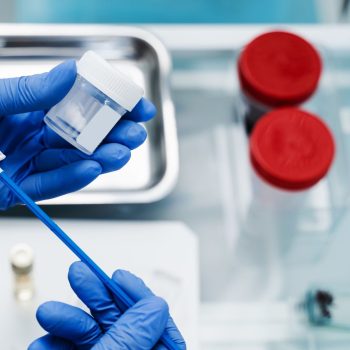 Examen PAP: ¿Qué es, para qué sirve y cuál es su valor?