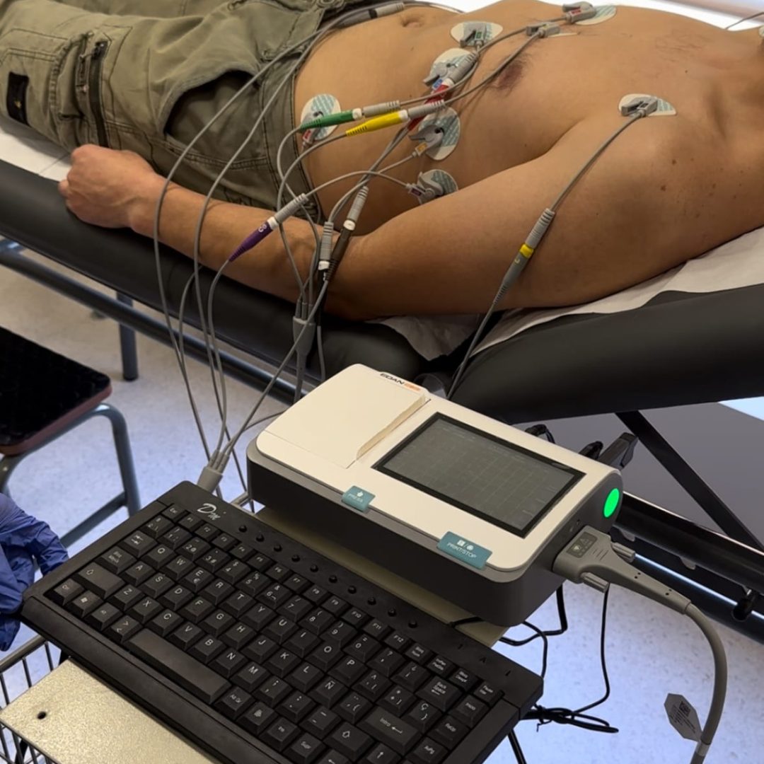 Electro-cardiograma
